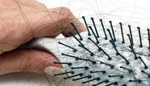 Non-Surgical Treatments for Hair Loss - Hair Fall