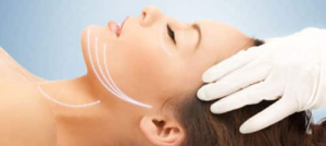 Facial Scar - Brief physiology of Ageing