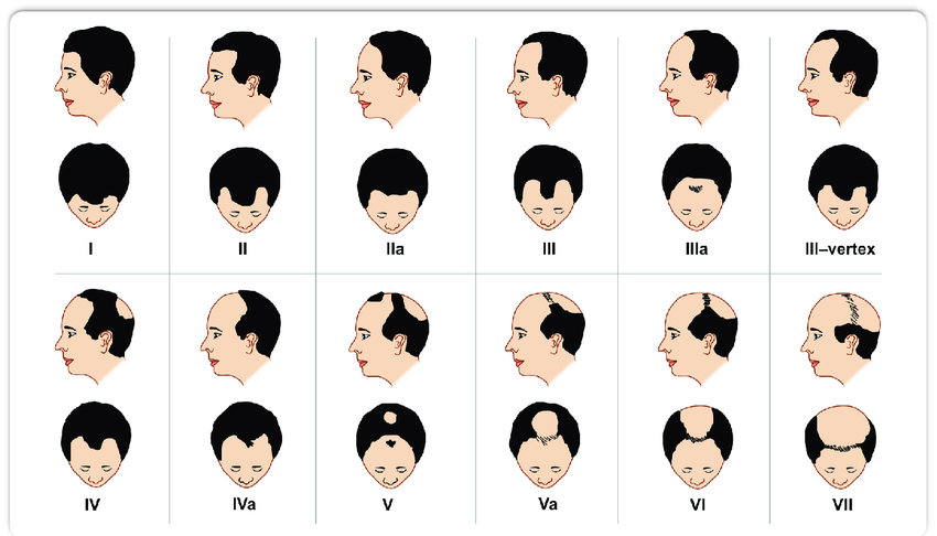 Hair Loss Center Treatment