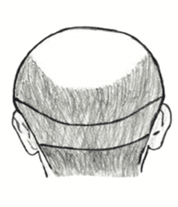 What Are Hair Fibers? - Hair Fibers Side Effects