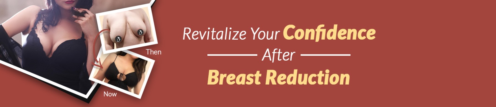 Female Breast Reduction Surgery Cost In Delhi India