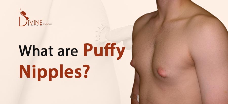 Why do You Have Puffy Nipples?