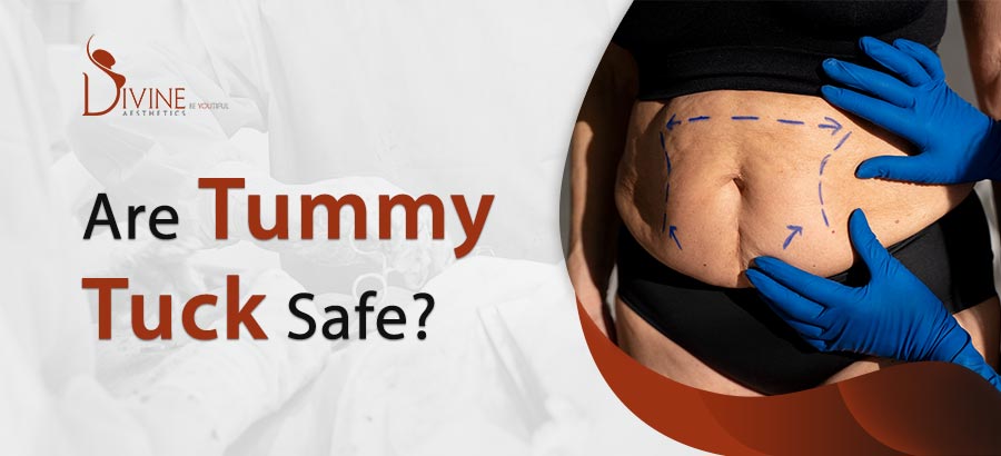 Are Tummy Tuck Safe? Tummy Tuck Risks and Safety Procedure with Benefits