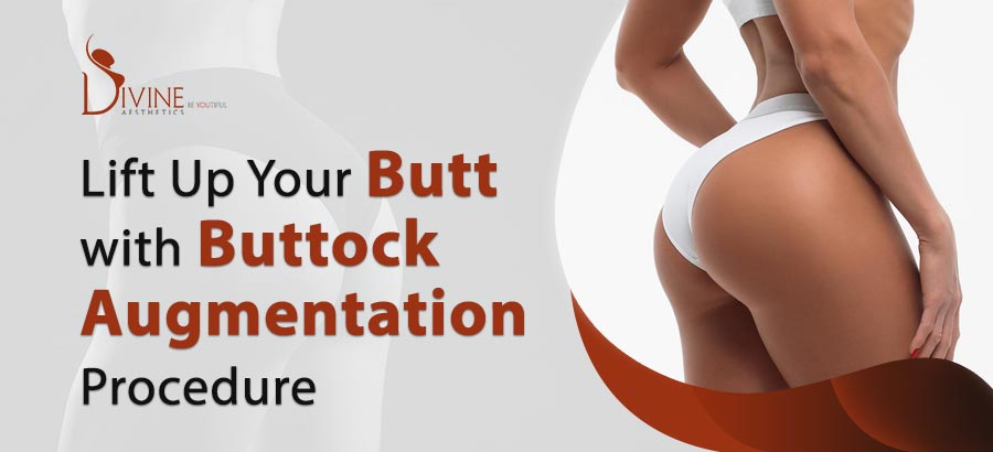 Lift Up Your Butt with Buttock Augmentation Procedure