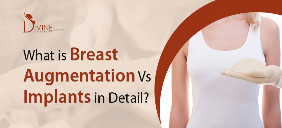What is Breast Augmentation vs Implants in Detail?
