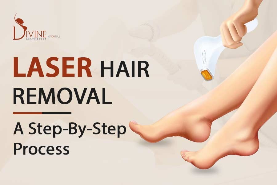 Laser vs Waxing Which Hair Removal Method is Better