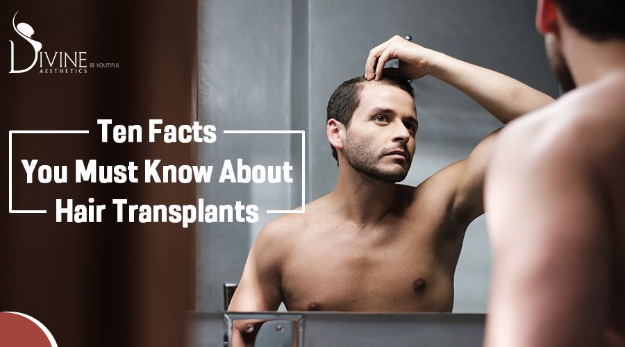 Ten Facts You Must Know about Hair Transplants