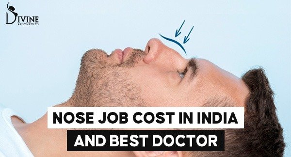 Nose Job Cost in India and Best Doctor