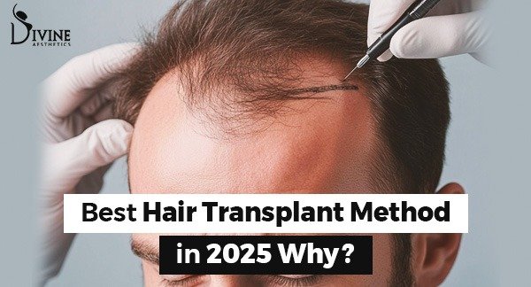 Best Hair Transplant Method in 2026 Why