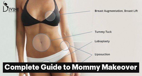 A to Z Complete Guide to Mommy Makeover by Dr Amit Gupta