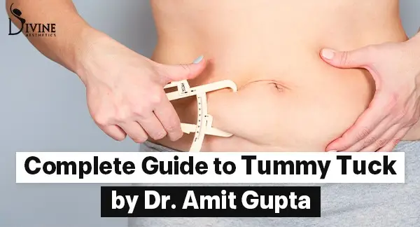 Complete Guide to Tummy Tuck by Dr Amit Gupta