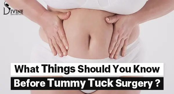 What Things You Should Know Before Tummy Tuck Surgery?