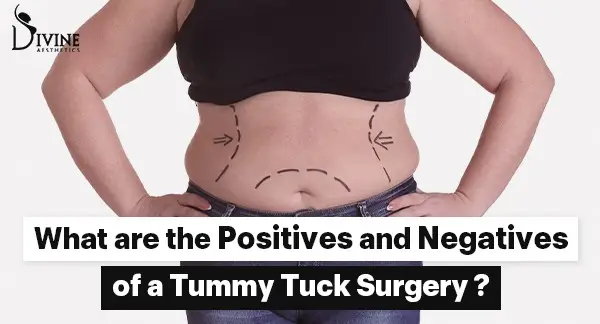 What are the positive and negatives of a tummy tuck surgery?